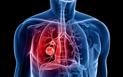 COPD Information